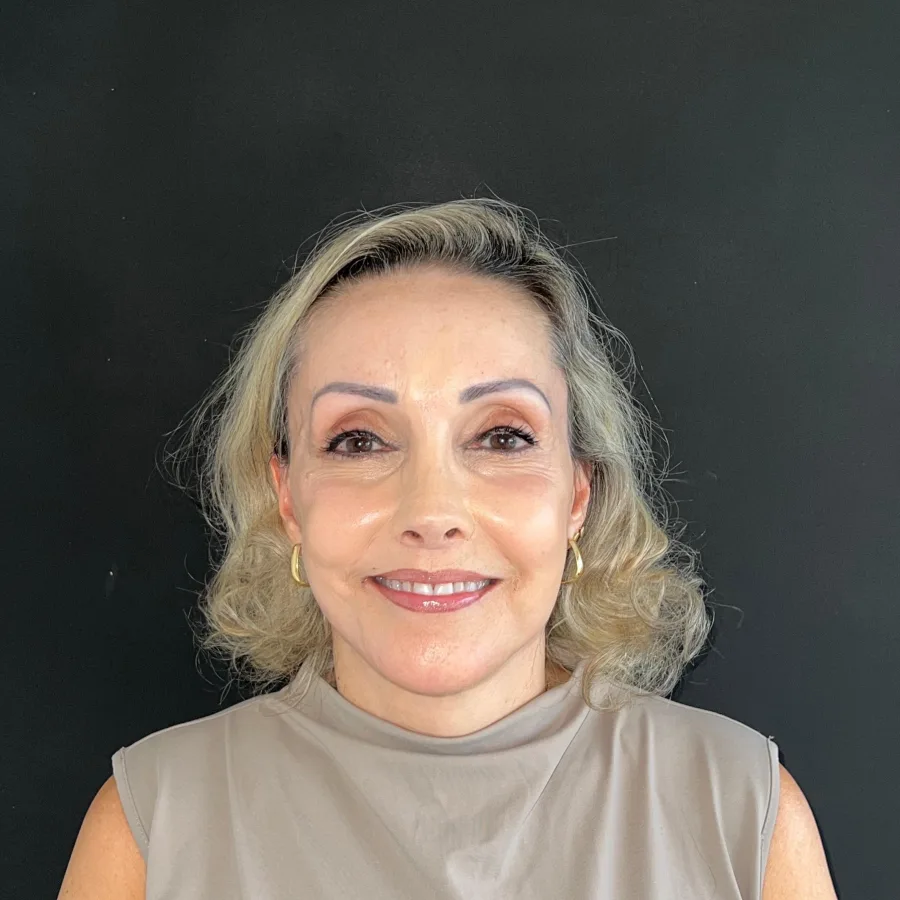 Depois — Caso 2